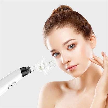 PurePore™ – Appareil de Nettoyage Visage & Extraction de Points Noirs ActiNest